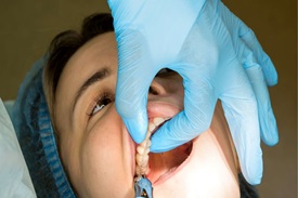 Minor Oral Surgery
