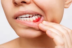 Gum (Periodontal) Treatments