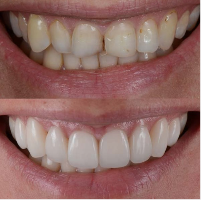COSMETIC DENTISTRY