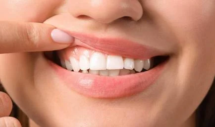 GUM & PERIODONTAL CARE